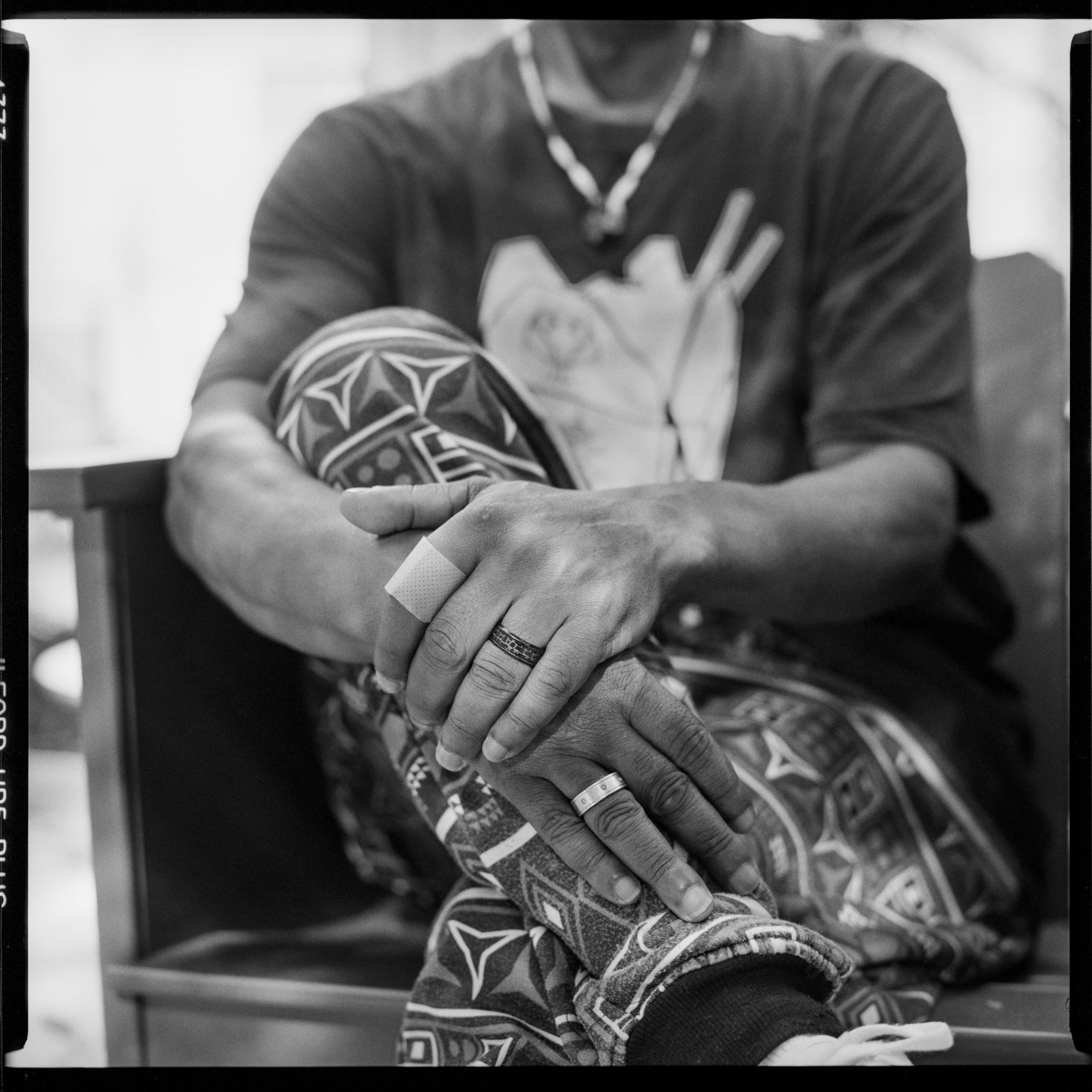 Image description: Black and white photograph of Michael’s hands. Michael is sitting with his legs crossed, his hands folded on his knee. His face is not visible. He has a bandage on one finger, and a ring on another finger. His pants are patterned in an African style.